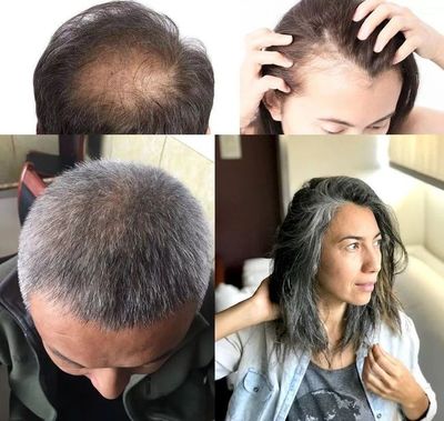 洗頭水中撒一把，頭發(fā)長得又快又茂密，白發(fā)都沒了！